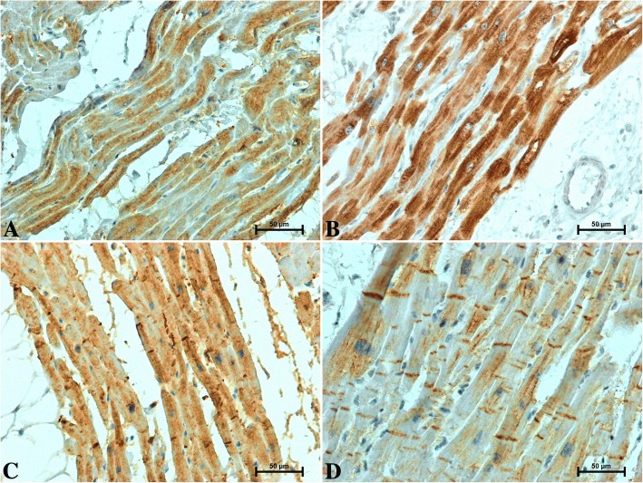 Representative images of CB1 immunolabelling in the heart of patients under 50 years old a men b women and over 50 years old c men d women