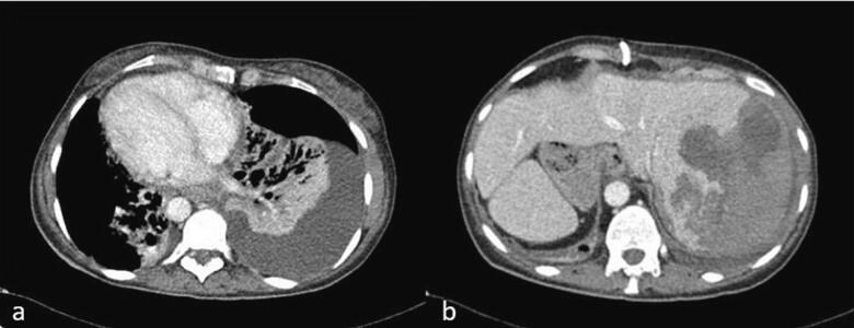 Fig. 4
