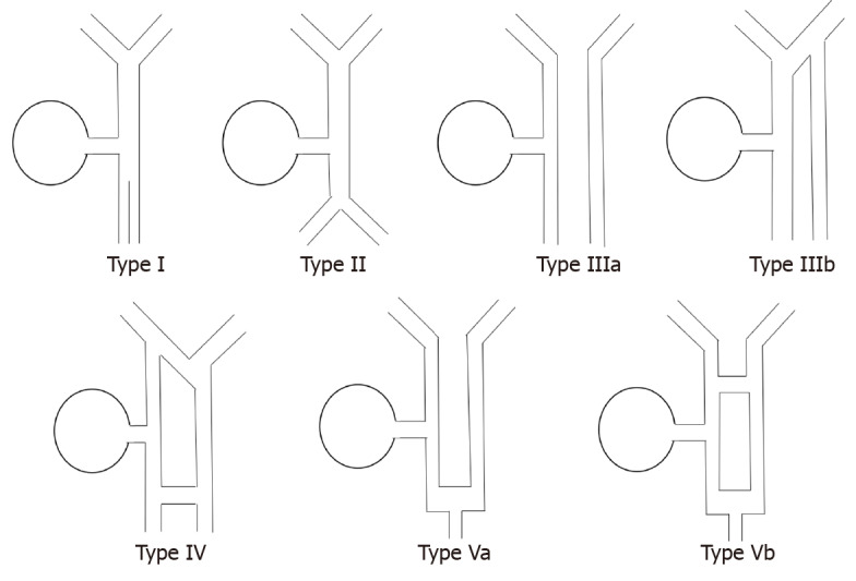 Illustration of Choi’s double common bile duct classification.