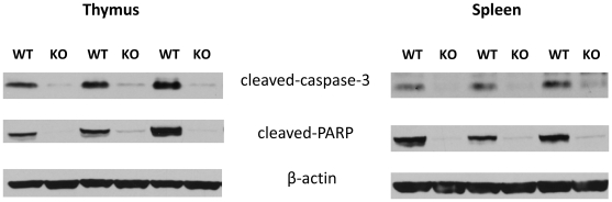 CB2 receptor deficiency decreases apoptosis in septic thymus and spleen.Proteolytic cleavage of caspase-3 and PARP in thymus and spleen protein extracts from CB2 WT and KO mice was examined using Western blotting. Bands were detected by enchanced chemiluminescence (ECL). Results shown are representative of 3 experiments.