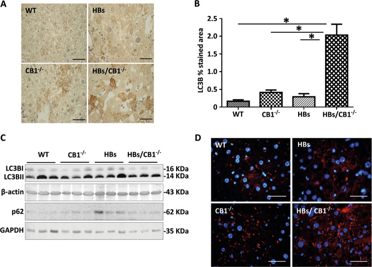 CB1 knockout elevated autophagy in the liver of HBs transgenic mice. a Representative immunohistochemical analysis of paraffin-embedded liver sections from 52-week-old mice was performed using anti-LC3B antibody. Original image magnification ×1000, bar 40 µm. b Quantification of LC3B puncta assessed with ImageJ software and expressed as % of LC3B staining/field. c Western blot analysis of lysates from 52-week-old mice was performed using specific anti-LC3B and anti-p62 antibodies. d Representative immunofluorescence analysis of paraffin-embedded liver sections of 52-week-old mice was performed using specific anti-LAMP1 antibodies (red). Nuclei were stained with DAPI (blue). Magnification ×1000, bar 40 µm