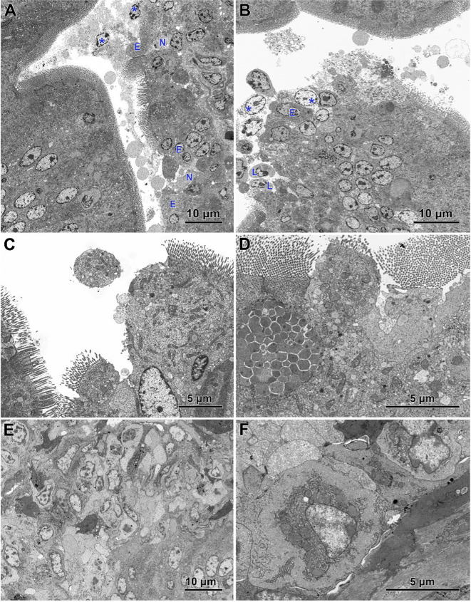Ultrastructure of intestinal epithelium in the jejunum of chickens infected with C. perfringens. (A) Necrotic areas (N) containing necrotic cells and cellular debris (asterisks) as well as abnormal enterocytes (E) lacking the cell polarity and microvilli. (B) The apical parts of the villi with the injured epithelium cover. Note necrotic cells (asterisks), lymphocytes (L), and irregularly shaped enterocytes without microvilli (E). (C, D) Areas of abnormal epithelium. Note the irregular arrangement of enterocytes. (E) Inflammatory cells inside the villus. (F) Smooth muscle cells inside the villus.