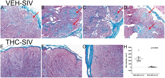 VEH/SIV rhesus macaques have significantly high amounts of collagen deposition in lymph node paracortex and B-cell follicles (A–D) (red arrows) compared to THC/SIV rhesus macaques (E–G). Note blue staining collagen (red arrow) (Gomori one-step trichrome stain) in (A–D). Image quantification confirmed high collagen deposition in lymph nodes of VEH/SIV rhesus macaques (H).