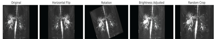 Augmented MRCT images.