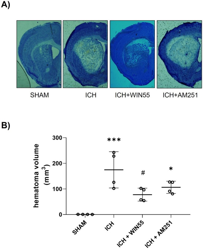 Hematoma volume in animals after ICH and treated with WIN55 or AM251. (A) Representative micrograph of coronal striatal sections stained with cresyl violet. The scale bars represent 200 μm. (B) Quantifying the hematoma volume is expressed in cubic millimeters (n = 4). Results were expressed as means ± standard deviation *p < 0.05, ***p < 0.001 vs. the SHAM; #p < 0.05 vs. the ICH group.
