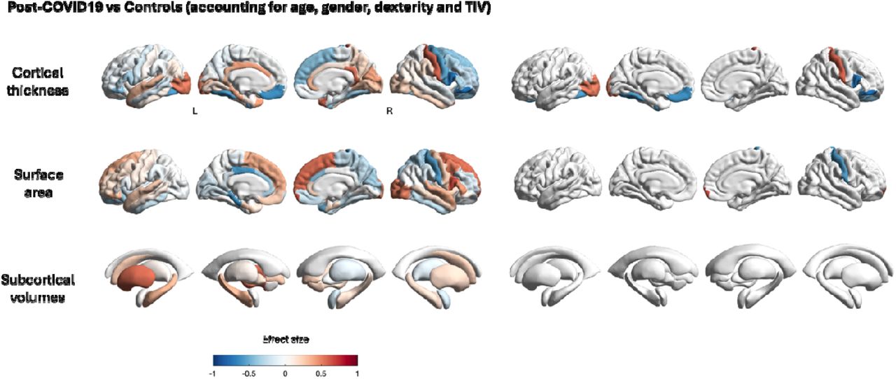 Regional differences in cortical thickness, surface area, and subcortical volumes deviation scores between post-COVID-19 patients and healthy controls.Comparisons were adjusted for age, gender, handedness, and total intracranial volume (TIV). Colours indicate effect sizes (Cohen’s d), with red representing increased measures and blue indicating decreased measures in post-COVID-19 patients compared to controls. Significant results are thresholded at uncorrected p < 0.05.