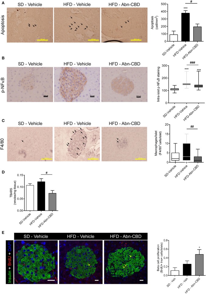 Effect of Abn-CBD on pancreatic beta-cell viability and intra-islet inflammation. Representative photomicrographs and quantification of islets immunostained for apoptosis (A) and p-NFκB (B); arrows indicate apoptotic cells; p-NFκB immunostaining was counterstained with haematoxylin. (C) F4/80 staining; arrows indicate macrophages. (D) Quantification of lipid peroxidation by TBARS production. (E) Representative photomicrographs of double insulin (green) and BrdU (red) immunostaining in islets and quantification of BrdU+/Insulin+ cells; arrows indicate proliferative beta cells; scale bar is 20 μm. n = 6 SD-Vehicle, n = 7 HFD-Vehicle and n = 8 HFD-Abn-CBD. *p ≤ 0.05 and ***p ≤ 0.001 compared to SD-Vehicle; #p ≤ 0.05, ##p ≤ 0.01, and ###p ≤ 0.001 compared to HFD-Vehicle.