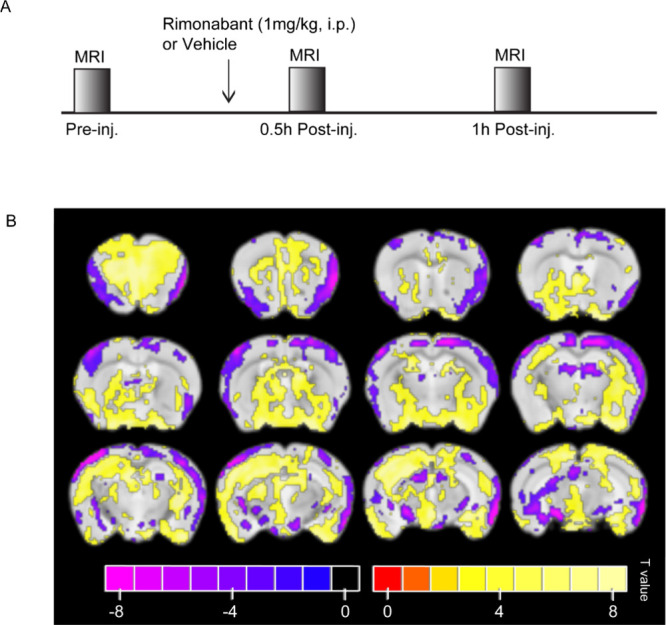 Rimonabant administration induced BOLD positive and negative activation in the brain. (A) Scheme of the mouse drug challenge and MR scanning timeline. (B) Group (n = 8/group) statistical parametric maps showing changes in BOLD contrast with a significance threshold set to p < 0.05 (corrected with SGoF) following acute administration of rimonabant (1 mg/kg body weight, i.p.), baseline vs 60 min (first level), vehicle vs rimonabant (second level). Blobs in warm colors (right) indicate regions of increased BOLD signal compared with vehicle, whereas blobs in cool colors (left) are regions of decreased BOLD signal.