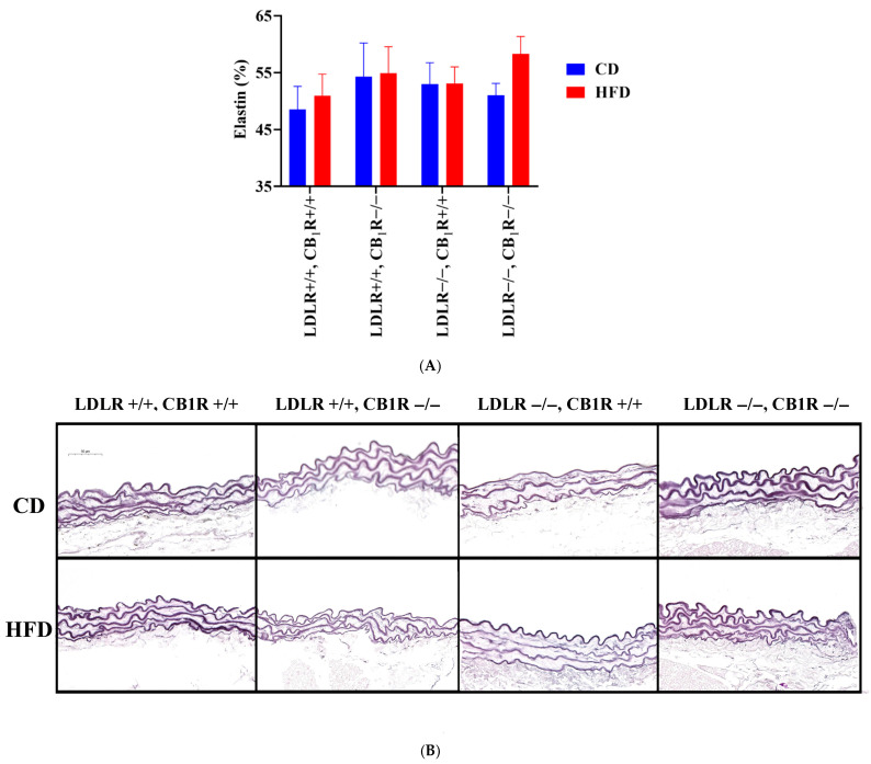 (A). Elastin fiber density expressed in elastin % of resorcin-fuchsin stained aortas from mice with genotypes LDLR+/+CB1R+/+ (wild-type), LDLR+/+CB1R−/−, LDLR−/−CB1R+/+ and LDLR−/− CB1R−/− kept on a control diet or on a high-fat diet for 5 months. (B). Representative photos of RF-stained aortas are shown. Mean ±SEM values are shown (A). Abbreviations: LDLR: low-density lipoprotein receptor, CB1R: cannabinoid type 1 receptor, CD: control diet, HFD: high-fat diet.