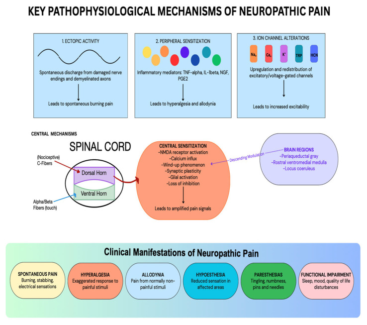 Key Pathophysiological Mechanisms of Neuropathic Pain [2,5,6,7].