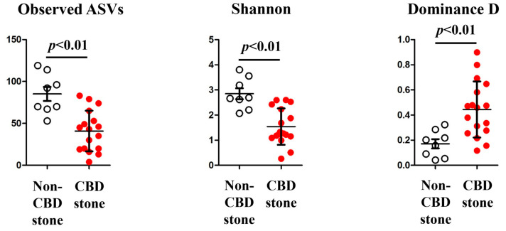 Alpha diversity (Observed ASVs, Shannon, and Dominance D). The observed ASVs, Shannon, and dominance D were compared between the non-CBD stone group (represented by white dots) and the CBD stone group (represented by red dots).