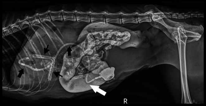 Post‐operative right lateral abdominal radiograph for Case 2. The biliary drainage catheter (thick black arrows) and stent (thin black arrows) are appropriately placed. There is a kink (white arrow) noted in the biliary drainage catheter. There is persistent contrast within the gastrointestinal tract.