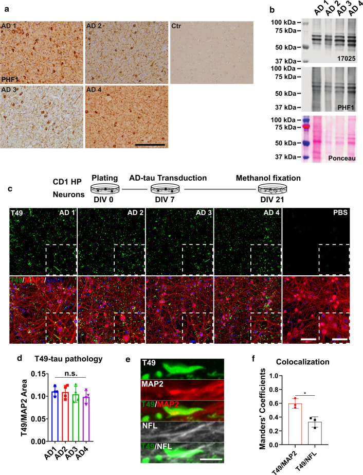 Insoluble tau from different AD cases exhibits consistent seeding abilities in WT mouse primary neurons. a Immunohistochemistry (IHC) of frontal cortex sections from different AD patient brains and non-tau pathology control using the PHF1 anti-phosphorylated-tau antibody; scale bar = 500 µm. b Immunoblot of sarkosyl-insoluble AD-tau probed with a total tau (17,025) and a phospho-tau (PHF1) antibody; ponceau staining shows total protein in the samples. c Immunocytochemistry (ICC) of AD-tau-induced mouse tau pathology in CD1 mouse primary hippocampal neuron cultures revealed by a mouse tau-specific antibody (T49) with concomitant staining of cell nuclei (DAPI) and neuronal dendrites (MAP2 antibody); scale bar = 100 µm and 25 µm (inset). The schematic diagram shows the experimental paradigm for the neuron culture-based activity assay. d Quantification of T49-mouse tau pathology from c. T49-postive area was normalized to the MAP2 positive area; n.s. nonsignificant for all groups; one-way ANOVA followed by Tukey post hoc test; n = 4. e Representative images of T49-positive tau pathology shows the relative location of AD-tau induced mouse tau pathology in dendrites (MAP2) and axons (NFL); scale bar = 5 µm. f Colocalization of T49/MAP2 and T49/NFL from e; n = 3