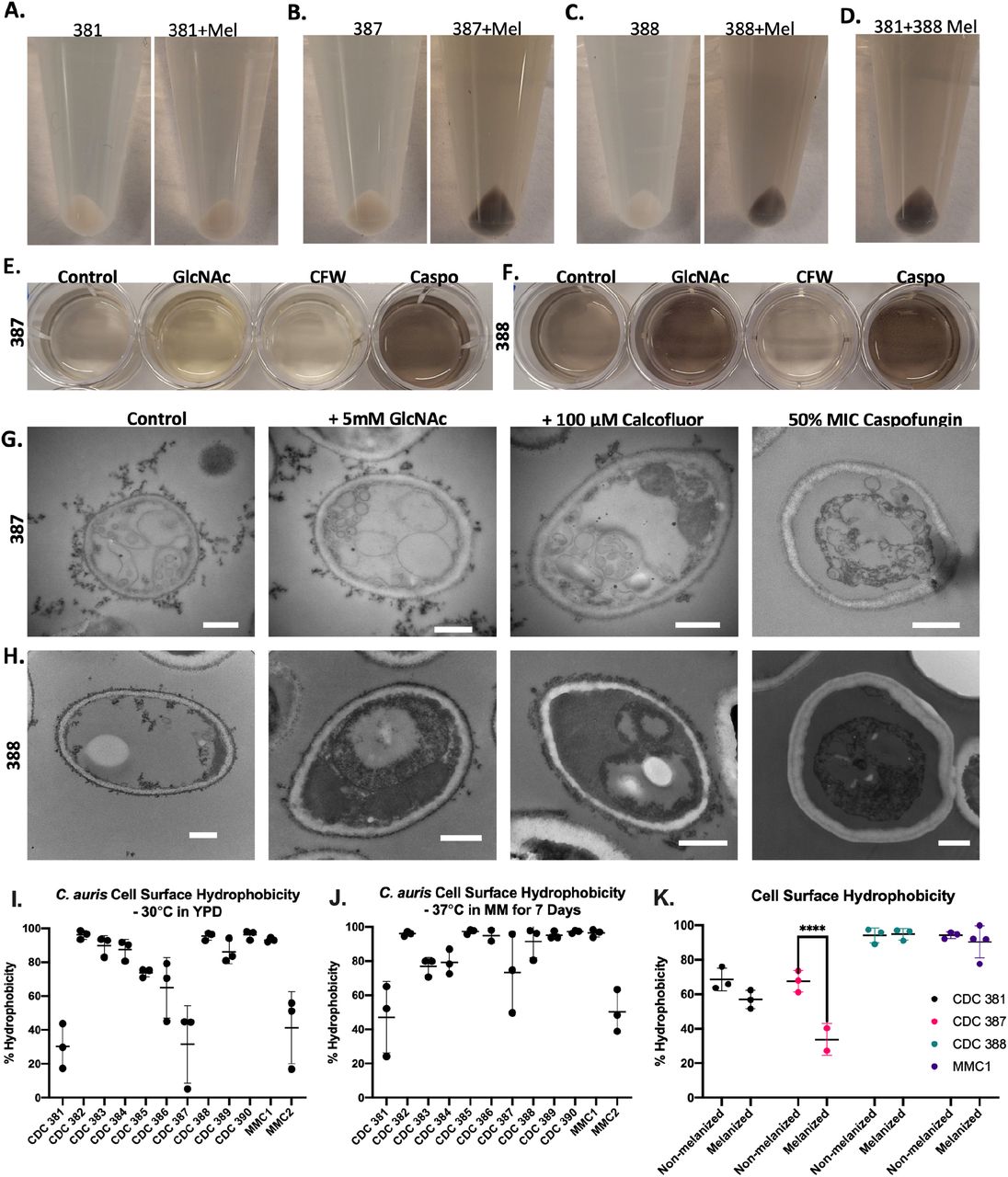 Extracellular melanin adheres to cell wall and is blocked following β-Glucan inhibition.(A-C) Adding non-melanized cells to the melanized supernatant from its corresponding strain resulted in pigmented cells after 3 hours of incubation. (D) The melanized supernatant from the CDC 388 strain causes the non-melanizing CDC 381 strain to become pigmented. Adding the building block for chitin, GlcNAc, to the CDC 387 (E) and CDC 388 (F) strains resulted in increased supernatant melanization, blocking chitin synthesis with CFW resulted in less melanin in supernatant but also caused melanin-coated CFW crystals on the fungal surface. Blocking beta-Glucan synthesis with caspofungin resulted in increased supernatant melanization in both strains. (G-H) Electron microscopy revealed no major differences in melanin adherence to the cell wall in either the CDC 387 (G) and CDC 388 (H) strains treated with GlcNAc. There were clear electron-dense crystal structures on the cell walls of CFW conditions, and the caspofungin-treated conditions had little to no melanin on the cell surface. While caspofungin-treated cells grew in culture, they look atypical in TEM with a condensed cytoplasm. All scale bars represent 500 nm. (I,J) There is no association between the hydrophobicity of a C. auris strain and its ability to melanize. (K) Although the melanization of certain strains, namely CDC 387, results in a significant reduction of CSH compared to its non-melanized control, no statistically reduction occurs in CDC 381, 388, or MMC1 strains. All experiments are representative of three biological replicates. Statistical differences were tested with a Two-Way ANOVA with multiple comparisons using Prism GraphPad, with p<0.0001 = ****. Error bars indicate standard deviation.