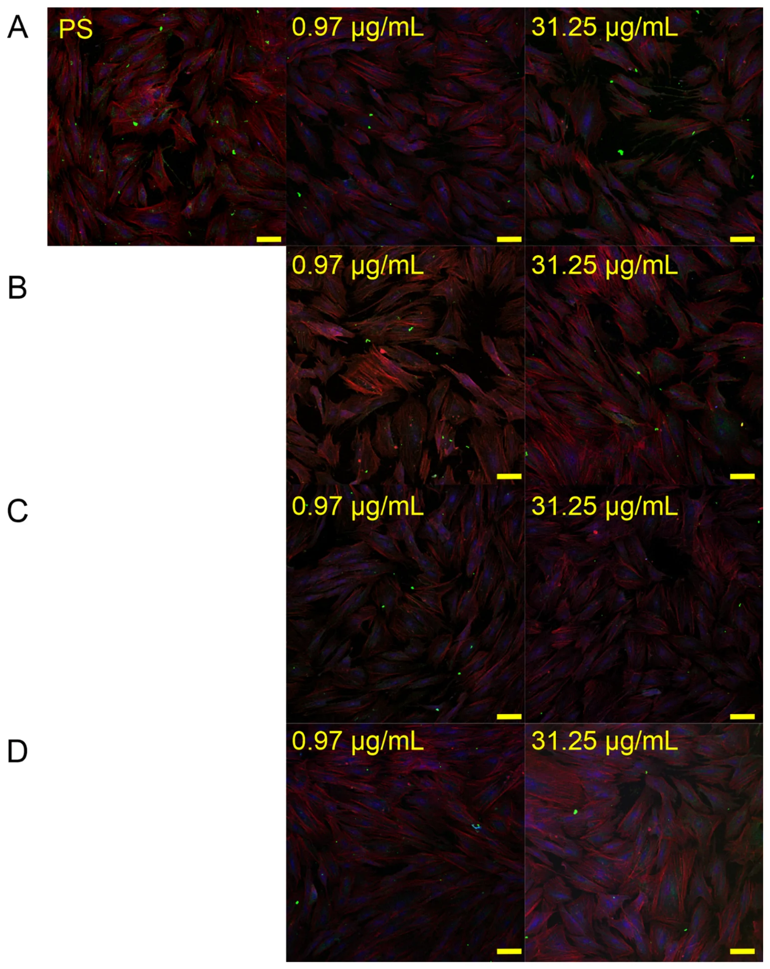 Representative confocal laser scanning microscopy (CLSM) images of immunofluorescence staining of BJ human skin fibroblasts after 4 days of incubation with essential oils obtained from UFL, LFL, UFR and LFR at concentrations of 0.97 and 31.25 µg mL−1. Cell nuclei were stained with Hoechst 33342 (blue fluorescence), the cytoskeleton/F-actin was stained with Alexa Fluor 635 (red fluorescence), and collagen type I was visualized using an Alexa Fluor 488-conjugated secondary antibody (green fluorescence). Images were acquired at 200× magnification. Scale bar = 100 µm. (A)—essential oils obtained from flowers, bracts and leaves of the upper part of the inflorescence; (B)—essential oils obtained from flowers, bracts and leaves from the lower part of the inflorescence; (C)—essential oils obtained from bracts and leaves from the upper part of the infructescence; (D)—essential oils obtained from bracts and leaves of the lower part of the infructescence. PS—negative control (cells cultured on tissue culture polystyrene, without EO treatment).