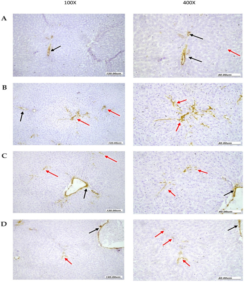 Immunohistochemistry for alpha-smooth muscle actin in rat livers. (A) Normal liver tissue showing SMA staining limited to vascular walls (black arrow). The surrounding liver parenchyma shows no SMA staining (red arrow). (B) Liver tissues from NASH control group showing moderate SMA staining of stellate myofibroblast cells (red arrow) extending between liver cells within liver parenchyma with arborizing branching pattern between hepatocytes along sinusoidal walls. There are scattered vessels showing staining at periphery (black arrow). (C) Liver tissues from the NASH + hemp seed oil group showing focal moderate SMA staining of stellate myofibroblast cells (red arrow) extending early between liver cells within liver parenchyma. There are scattered vessels showing staining at the periphery (black arrow). (D) Liver tissues from the NASH + NEF#4 hemp seed oil group showing minimal very focal weak SMA staining of a very small number of myofibroblast cells (red arrow), minimally extending between liver cells within the liver parenchyma. There are scattered vessels showing staining at the periphery (black arrow).