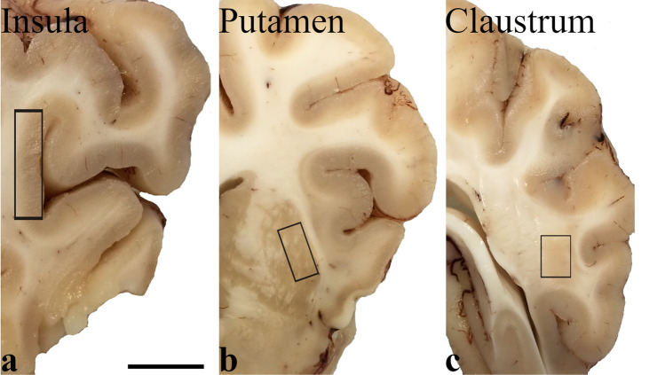 Photographs of coronal sections (a most cranial, c most caudal) of pig brain showing the sampled regions (black rectangles). Samples were taken from the insula (a), putamen (b), and caudal claustrum (c), and the latter was characterized by a large mass of about 0.5 cm in diameter. Scale bar = 1 cm