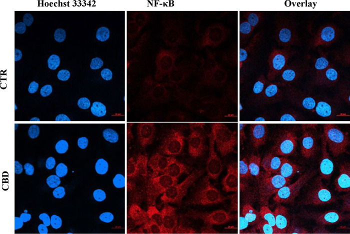 Effect of CBD in NFKB regulation in PC3 cells.CBD treatment (10μM) for 48h led to induction of NFkB (red colour) in most cells and its nuclear localization (overlapped with blue nuclear stain). Scale bars were provided on the right side bottom of all images.