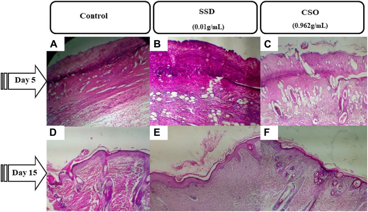 Photomicrographs of burned skin sections 5 days and 15 days after burns and various treatments. (A) untreated negative control on day 5, (B) group treated with SSD on day 5, and (C) group treated with CSO on day 5. (D) Untreated negative control group on day 15, (E) group treated with SSD on day 15, and (F) group treated with CSO on day 15. Images are acquired at a magnification of 100×.