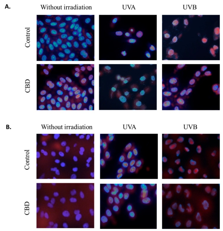 The influence of cannabidiol (CBD, 1 µM) on Nrf2 (A) and NFκB (p52) (B) nuclear localization in keratinocytes (control and exposed to UVA (30 J/cm2) and UVB (60 mJ/cm2) radiation). Nuclei were stained with Hoechst 33342 (blue) and antibodies against Nrf2 or NFκB (p52) were detected with fluorescent (FITC) secondary antibody (red dots).