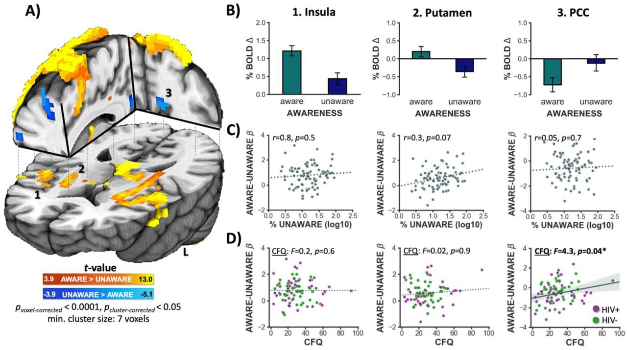 Whole-brain activity following aware [A] and unaware [U] errors.A) Across the sample of 86 participants committing a sufficient number of aware and unaware errors, explicit error awareness was associated with increased activity in the bilateral insula, bilateral putamen, posterior thalamus, and bilateral primary motor cortex extending into supplementary motor regions (warm colors: A>U, pcorrected<0.05). On the other hand, unaware error trials were associated with increased activity (i.e., less deactivation) of the bilateral posterior cingulate cortex (PCC) (cold colors: U>A). B) Mean percent BOLD signal change (β) values for aware and unaware error trials for the (1) right insula, (2) right putamen, and (3) left PCC. C) Correlations between the percent of unaware errors and [A-U] contrast values from each ROI. More aware (vs. unaware) error-related brain activity in the right putamen correlated with a higher percentage of unaware errors, but this association did not survive multiple comparison corrections (pBonferronni-corrected =0.07). D) A main effect of CFQ total scores on left PCC (p=0.04) awareness-related activity was detected such that across all participants, more PCC deactivation following aware (vs. unaware) errors was linked with fewer self-reported cognitive failures. See Supplemental Table S8 for cluster coordinates.