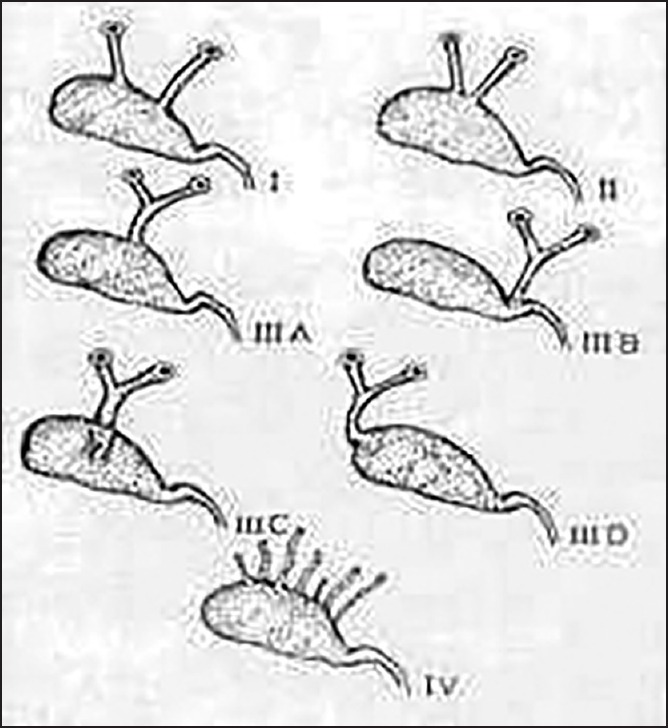Variants of interposition of the gallbladder
