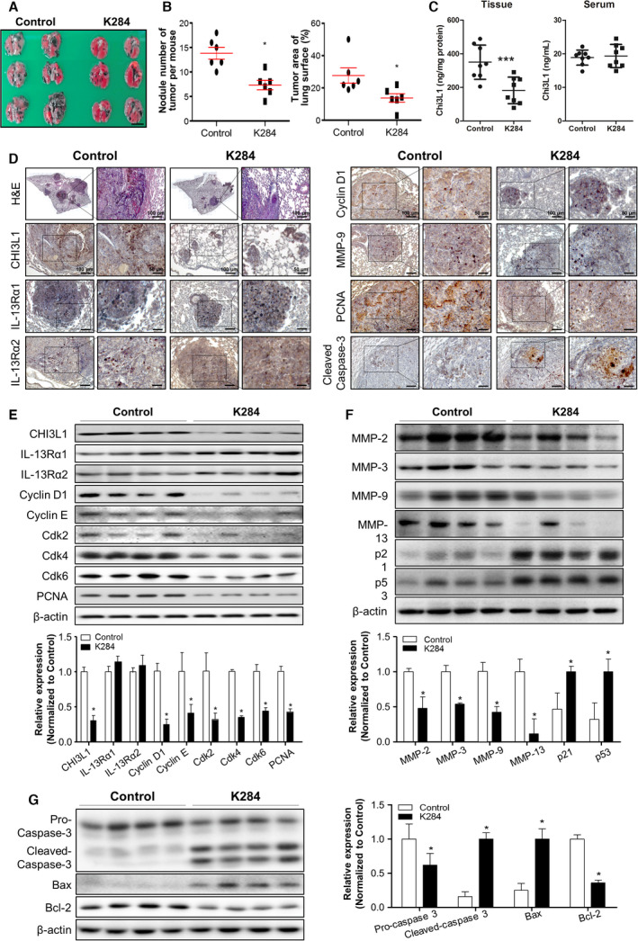 Effect of K284 on B16F10 melanoma metastasis to the lungs in C57BL/6 mice. (A) Images of lung metastasis of melanoma in C57BL/6 mice. B16F10 melanoma cells were injected in C57BL/6 mice that were then intravenously administered via the tail vein saline (left) or 0.5 mg·kg−1 K284 (right) at 3‐day intervals for 3 weeks. n = 6 per group. Scale bar, 5 mm. (B) The number of tumor nodules and area of mouse lung tissues were measured. n = 6 per group. *P < 0.05 (vs. control). (C) The tissue and serum levels of CHI3L1 were analyzed by ELISA. n = 6. ***P < 0.001 (vs. control). (D) Hematoxylin and eosin (H&E) staining of lung tissue sections. Immunohistochemical analysis for CHI3L1, IL‐13Rα1, IL‐13Rα2, cyclin D1, MMP‐9, PCNA, and cleaved caspase‐3 in lung tissue sections. Scale bar, 100 μm. Scale bar of enlarged image, 50 μm. (E) Western blot analysis for CHI3L1, IL‐13Rα1, IL‐13Rα2, cyclin D1, cyclin E, Cdk 2, Cdk 4, Cdk 6, and PCNA from the lung tumor metastatic tissue lysate of C57BL/6 mice. The relative protein expression in the K284‐treated group compared with that in the control group is shown in the graphs. *P < 0.05 (vs. Control). (F) Western blot analysis for MMP‐2, MMP‐3, MMP‐9, MMP‐13, p21, and p53 from the lung metastatic tissue lysate. The relative protein expression in the K284‐treated group compared with that in the control group is shown in the graphs. *P < 0.05 (vs. control). (G) Western blot analysis for caspase‐3, Bax, and Bcl‐2 from the lung tumor metastatic tissue lysate of C57BL/6 mice. The relative protein expression in the K284‐treated group compared with that in the control group is shown in the graphs. *P < 0.05 (vs. control). All error bars of graph reported are the standard deviation (SD) from three independent experiments.