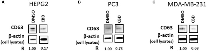 CD63 exosomal marker is reduced following 1 h CBD treatment in HEPG2, PC3, and MDA-MB-231 cancer cells. The results from the NTA analysis were confirmed by Western blotting for the exosomal CD63 marker, which was reduced in all three cell lines following 1 h treatment with 5 μM CBD: (A) CD63 expression is reduced in CBD treated versus DMSO control treated HEPG2 cancer cells; (B) CD63 expression is reduced in CBD treated versus DMSO control treated PC3 cells; (C) CD63 expression is reduced in CBD treated versus DMSO control treated MDA-MB-231 cells. All EMV preparations were performed in equal buffer volume (50 μl) and all cell lysates were prepared in equal buffer volume (50 μl) between all samples, for accurate presentation of amounts of vesicles isolated and amounts of cells grown and collected per flask. For EMV isolates, 20 μl of sample was loaded per lane, while for β-actin detection in the corresponding cell lysates, 10 μl of sample was loaded per lane. The relative detection of CD63 in EMVs released from the corresponding cell preparation is indicated by “R,” in relation to β-actin detection in the corresponding cell isolate, for comparison between CBD treatments versus DMSO control.