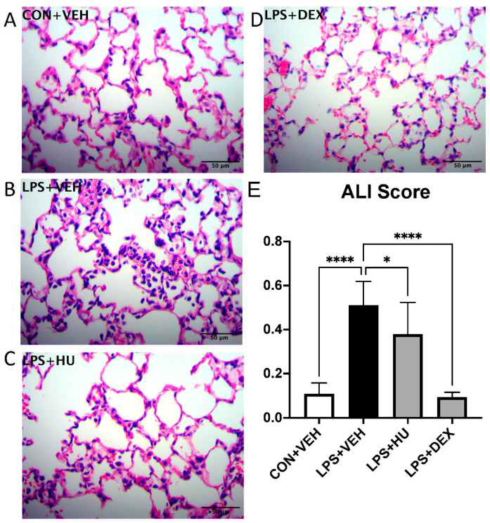 Impact of treatment on LPS-induced lung histopathology. Representative FOV of (A) con + veh and LPS + (B) veh, (C) HU-308, and (D) DEX mice. (E) Histopathological lung scores. Data are expressed as mean ± SD. Statistically significant differences were determined via one-way ANOVA with Dunn’s multiple comparisons test and are depicted as * p ≤ 0.05, **** p ≤ 0.0001.