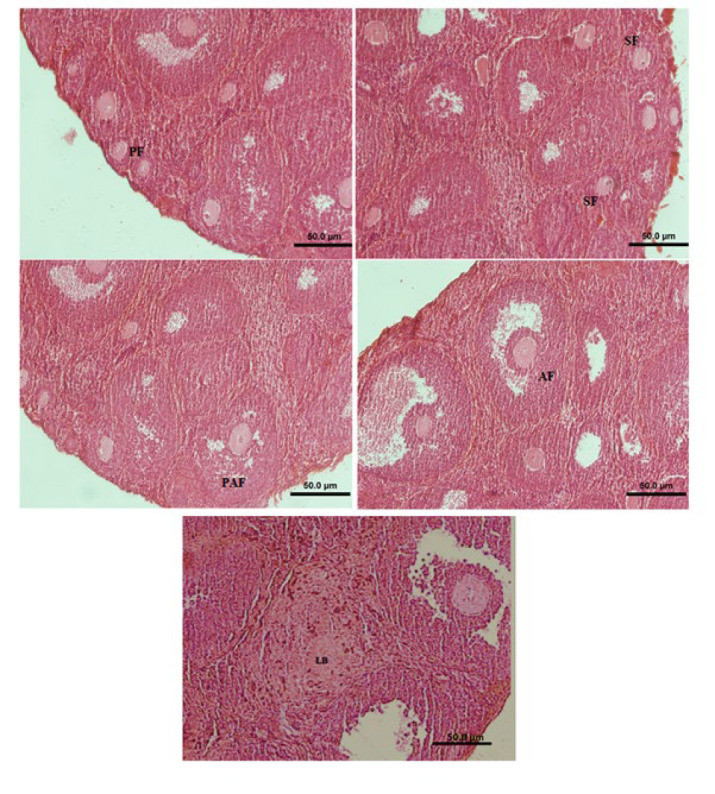 Primary follicle (PF), Secondary follicle (SF), Preantral follicle (PAF), Antral follicle (AF) and Luteal body (LB)