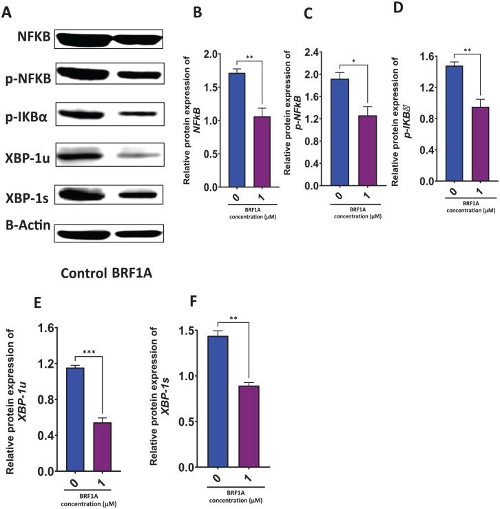 BRF1A suppressed the expression of targets critical for the survival and function of IgE-producing myeloma cells (U266 cells). U266 cells were cultured with BRF1A at a concentration of 1 µM for 24 hours. Western blot assay was conducted as described in the section “Materials and Methods”. (A) Western bands (B) NFκB. (C) p-NFκB. (D) p-IκBα. (E) XBP1u. (F) XBP1s.Data represent triplicate experiments and are expressed as mean ± SD. *P < .05; **P < .01, ***P < .001 versus control (0.1% DMSO).