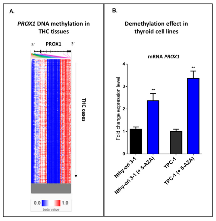 Methylation in THC cases. A. Hierarchical clustering of THC tissues; blue indicates a low level or no methylation for PROX1; red indicates a high methylation level. The methylation analysis was studied using https://xenabrowser.net/heatmap/. B. Treatment of the immortalized normal thyroid cells (Nthy ori-3-1) and PTC-derived cell line (TPC-1) with 5 µM 5-aza-2’-deoxycytidine for 24 h, ** p ≤ 0.01.