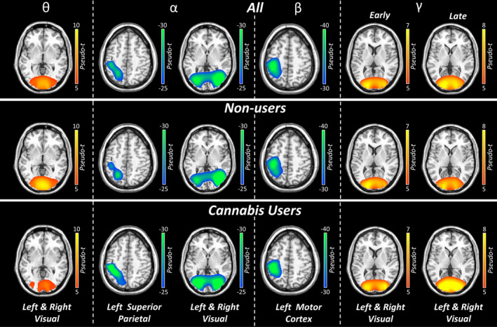 Grand‐averaged beamformer images across both conditions. Grand‐averaged beamformer maps for each oscillatory response window are shown in pseudo‐t units. In the top row, images have been averaged across both conditions and both groups and depict the strongest neural oscillatory responses contributing to the sensor‐level data. In the bottom two rows, images have been averaged across both conditions but are shown separately per group.