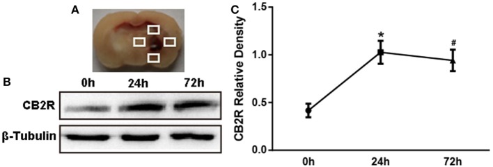 The expression of cannabinoid receptor-2 (CB2R) after intracerebral hemorrhage (ICH). The coronal section of specimen (A). Western blot test (B) of CB2R expression in total tissue around the hematoma (shown as the white quadrangles) at 0, 24, and 72 h after ICH, and the relative densitometric values analysis (C). Values were expressed as the mean ± SD, n = 6 in per group. *P < 0.05 vs. 0 h group; #P > 0.05 vs. 24 h group.