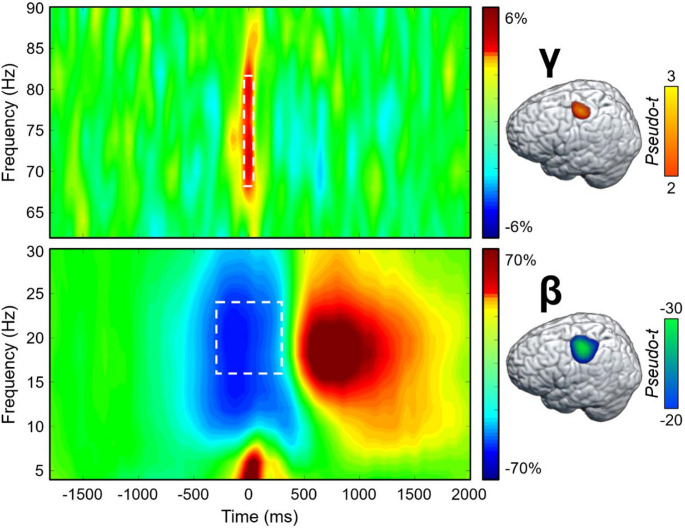Motor-related neural oscillatory responses. (Left): Grand-averaged time-frequency spectrograms from MEG sensors near the precentral gyrus (top: MEG0432; bottom: MEG0443) exhibiting a significant motor-related gamma response (top; 68–82 Hz, -75 to 75 ms) and a peri-movement beta ERD response (bottom; 16–24 Hz, -300 to 300 ms). The spectrograms display frequency (Hz) on the y-axis and time (ms) on the x-axis. Signal power is expressed as a percent difference from the baseline period, with the color legend shown to the right of the spectrogram. Note that the post-movement beta rebound (PMBR) response can also be seen, but this was not further examined since it happened after the movement, and we were interested in the motor planning and execution aspects of the task. (Right): Grand-averaged beamformer images (pseudo-t) across all participants for each significant time-frequency component