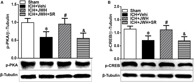 The expression of pPKA–CREB signaling pathway at 24 h after intracerebral hemorrhage (ICH). Total protein around the hematoma was extracted for investigation. Western blot analysis was used to detect the protein expression of (A) pPKA and (B) pCREB. Values of the relative densitometric analysis were expressed as mean ± SD, n = 6. *P < 0.05, **P < 0.01 compared with sham group; #P < 0.05, ##P < 0.01 compared with ICH + Vehi group; &P < 0.05, &&P < 0.01 compared with ICH + JWH group.