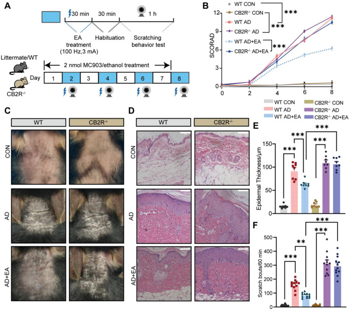 CB2R knockout mitigates the therapeutic efficacy of EA on AD-like lesions and chronic pruritus. A The protocol regarding the establishment of the AD model, the EA treatment and the detection time of chronic pruritus behavior in WT and CB2R−/− mice. B Time-course of SCORAD scores(n = 8). C Representative images of skin lesions from each group of mice on day8. D Representative H&E staining images of each group. Scale bar = 100 μm. E Quantitative measurement of epidermal thickness based on the H&E images (n = 8). F Total number of scratches performed by mice in each group within one hour on day 8 (n = 12). All data are shown as mean ± S.E.M. Analysis was performed using two-way ANOVA complemented by Sidak's test for multiple comparisons, *p < 0.05, **p < 0.01, ***p < 0.001