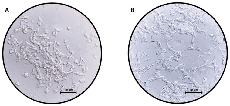 Images of (A) undifferentiated SH-SY5Y neuroblastoma cells and (B) SH-SY5Y neuroblastoma cells differentiated with RA for 5 days. The differentiation leads to changes in morphology; indeed, SH-SY5Y cells acquire a neuron-like phenotype when treated with RA. Scale bar: 20 µm.
