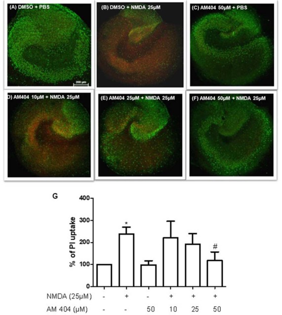 Effects of N-arachidonoylphenolamine (AM404) on excitotoxicity in mouse hippocampal slices cultures [n = 3 organotypic hippocampal slices cultures (OHSCs)/group]. (A–F) Representative confocal images of the immunostaining with propidium iodide (PI; red) and with the neuronal nuclear marker NeuN (green). (G) Quantitative analysis of the PI fluorescence. The results are expressed as mean ± SEM. *p < 0.05 with respect to negative control and #p < 0.05 compared with N-methyl-D-aspartic acid [NMDA; 25 μM; one-way analysis of variance (ANOVA), Newman–Keuls test].