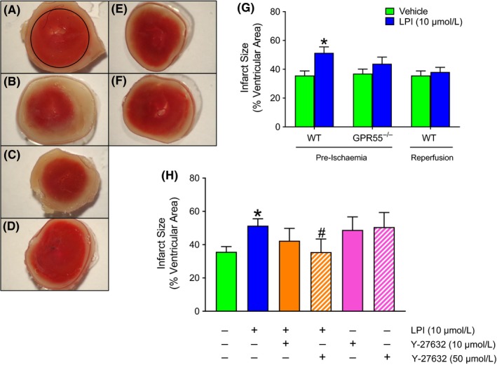 LPI increases myocardial infarct size in hearts from wild type, but not GPR55−/−, mouse hearts. Panels A‐F show representative images of TTC (1%) staining of transverse slices of hearts, delineating viable (red) and infarcted (white) tissue, from WT mice exposed to vehicle (A), LPI (10 μmol L−1; B) and LPI plus 10 μmol L−1 (C) or 50 μmol L−1 (D) Y‐27632 prior to 30 minutes global ischemia and 30 minutes reperfusion. Images of hearts from GPR55−/− mice challenged with vehicle (E) or LPI (F) are also shown. Panel G shows that LPI (10 μmol L−1) applied 10 minutes before the onset of global ischemia increased infarct size in hearts from WT (n = 14 each for vehicle and LPI), but not GPR55−/− (n = 5 for vehicle and n = 7 for LPI) mice, but not when applied 5 minutes into reperfusion (WT hearts only; n = 9). *P < 0.05 vs vehicle. The higher concentration (50 μmol L−1) of the ROCK inhibitor Y‐27632 reversed the effects of LPI‐induced injury in WT hearts (Panel H; n = 5 per group; *P < 0.05 vs vehicle; # P < 0.05 vs LPI alone)
