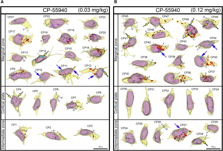 Collage of 3D reconstructions of migrating neurons from CP-55940 exposed embryos(A and B) Among a total of 49 analyzed cells, nuclear hernias were detected in 5 cells in the embryos exposed to low dose (A) and 9 cells in the embryos exposed to high dose of CB1R agonist CP-55940 (B). Herniated chromatin streams are shown in light blue, with streams resulting from NE ruptures pointed to using black arrows with yellow heads, and streams producing PNHs pointed to with blue arrows. The cells are positioned with pia-directed segments facing up and the ventricular surface-directed segments facing down. See Table S4 for morphometric characteristics of each cell. Reconstructed cell bodies with proximal segments of processes are shown in semi-transparent yellow, and nuclei are in semi-transparent violet. Most of the identified processes are incompletely reconstructed because of truncation in the serial sections. Anti-CB1R immunoreaction depositions are depicted in red. Centrioles (c) are depicted in green, procilia (ci) – in blue. Scale bars are valid for all the cells.