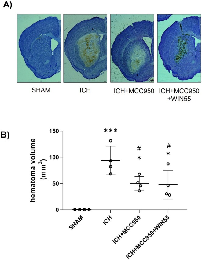 Hematoma volume in animals after ICH and treated with MCC950 or MCC950 plus WIN55. (A) Representative micrograph of coronal striatal sections stained with cresyl violet. The scale bars represent 200 μm. (B) Quantifying the hematoma volume is expressed in cubic millimeters (n = 4). Results were expressed as means ± standard deviation. *p < 0.05, ***p < 0.001 vs. the SHAM group; #p < 0.05 vs. the ICH group.