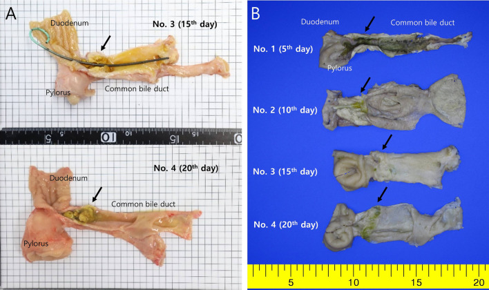 Histopathologic gross images of resected and longitudinally opened CBD. (A) Gross images of the common bile ducts, exposed immediately after excision. (B) Gross images of the common bile ducts after formalin fixation. Each APC application area (arrow) became thicker and more prominent over time in the third and fourth animals.
