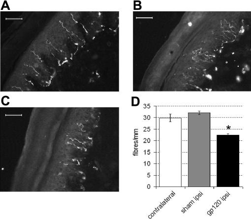 Intraepidermal nerve fibre density is decreased following perineural HIV-1 gp120. (A–C) Examples of PGP-9.5-immunoreactive profiles (A) contralateral to HIV-1 gp120, (B) ipsilateral to RSA or (C) ipsilateral to HIV-1 gp120 at day 14. (D) Immunohistochemical analysis of the glabrous skin of the hind paw reveals decreased IENF density ipsilateral to perineural HIV-1 gp120 by day 14 (n = 4) as compared to hind paw contralateral to treatment (n = 4) or ipsilateral to sham teatment (n = 4). Statistical significance of differences between groups (*P < 0.05) was determined by an ANOVA with Dunn’s all pairwise multiple comparisons. Each value is the mean ± SEM. Scale bar = 30 μm.