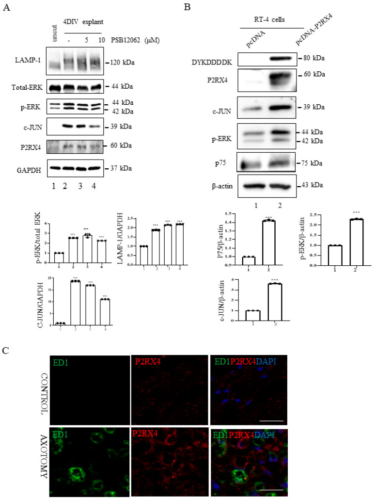 P2RX4 regulates p-ERK and c-JUN. (A) Sciatic nerve explants cultured for 4 DIV after P2RX4 antagonist (PSB1062) treatment exhibited decreased c-JUN and pERK levels. After the explants had been cultured, LAMP, ERK, c-JUN, P2RX4, and GAPDH proteins were collected for Western blotting. Uncut indicates freshly isolated sciatic nerves. The lower panel shows the Western blot results. n = 3. (B). Overexpression of P2RX4 by transfection with a pcDNA-P2RX4-DYKDDDDK-tagged plasmid enhanced the expression of pERK and c-JUN in RT4 Schwann cells. The lower panel shows the Western blot results. n = 3. Data are the mean ± SD. *** p < 0.001. (C) Immunofluorescence signals of P2RX4 (red) and ED1 (green, macrophage marker) in the sciatic nerve at 7 DIV. Scale bar = 20 μm.
