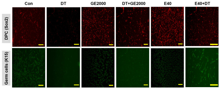 Images of the differentiated cells from hair follicle dermal papilla stem cells under various conditions. The results for the differentiated cells from hair follicle dermal papilla stem cells under different conditions (Con, control; DT, dihydrotestosterone; GE2000, germinated hemp seed extract 2000 µg/mL; DT+GE2000, DT 1 ng/mL after exposure to GE2000; E40, induced exosomes 40 μg/mL derived from the calli of germinated hemp seeds; E40+DT, DT1 after exposure to E40) (the scale bars = 30 μm).
