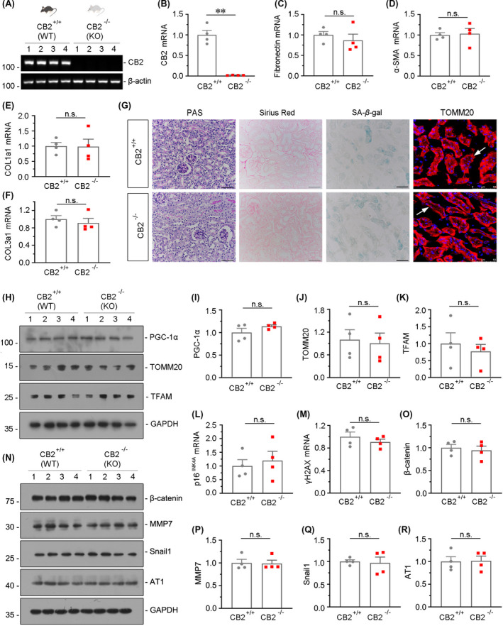 CB2 gene ablation does not affect kidney ageing or mitochondrial function in young mice. (A) RT‐PCR analyses showing renal expression of CB2 in wild‐type mice (WT) and CB2 knockout mice (KO). Numbers (1–4) indicate each individual animal in a given group. (B‐F) Quantitative real‐time PCR results showing renal expression of CB2, fibronectin, α‐SMA, CollagenⅠa1 and CollagenⅢa1 in WT and KO mice. **p < 0.01, n.s. versus WT mice group (n = 4). n.s.: no significance. (G) Representative micrographs showing Periodic acid‐Schiff (PAS) staining, Sirius red staining, senescence‐associated β‐galactosidase activity (SA‐β‐gal) staining and the expression of TOMM20. Paraffin‐embedded kidney sections were subjected to PAS and Sirius red staining. Frozen kidney sections were stained for SA‐β‐gal activity and TOMM20. Scale bar, 50 μm. (H‐K) Representative Western blot and quantitative data showing renal expression of PGC‐1α, TOMM20 and TFAM in WT and KO mice. Numbers (1–4) indicate each individual animal in a given group. n.s. versus WT mice group (n=4). n.s.: no significance. (L‐M) Quantitative real‐time PCR results showing renal expression of p16INK4A and γH2AX in WT and KO mice. n.s. versus WT mice group (n = 4). n.s.: no significance. (N‐R) Representative Western blot and quantitative data showing renal expression of β‐catenin, MMP7, Snail1 and AT1 in WT and KO mice. Numbers (1–4) indicate each individual animal in a given group. n.s. versus WT mice group (n = 4). n.s.: no significance