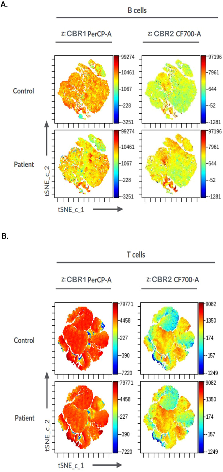 Figure contains eight color-coded tSNE plots showing B cell and T cell marker expression in control and patient samples. Panel A displays B cell (CBR1 PerCP-A and CBR2 CF700-A) intensities, while Panel B displays T cell markers, using a red-to-blue heatmap to highlight marker expression differences between groups.