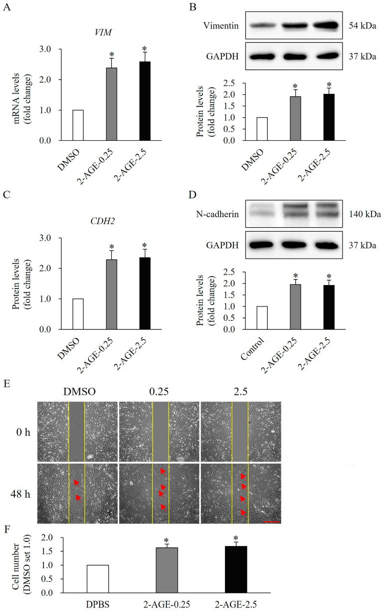 Effects of cannabinoid receptor 1 (CB1) agonist on expression of differentiation-related molecular and migration in human dermal fibroblasts (HDFs). Real-time polymerase chain reaction (PCR) analysis showing increased mRNA levels of (A) vimentin (VIM) and (C) N-cadherin (CDH2) in HDFs treated with 0.25 or 2.5 μM 2-arachidonyl glyceryl ether (2-AGE), a CB1-selective agonist, for 48 h compared with dimethyl sulfoxide (DMSO)-treated control cells. Western blot analysis showing increased protein levels of (B) vimentin and (D) N-cadherin in HDFs treated with 0.25 or 2.5 μM 2-AGE for 48 h compared with DMSO-treated cells. (E) Representative images of cell migration. The red arrow represents migrating cells. (F) Quantification of migration. Data are presented as mean ± SD, n = 3 per group. * p < 0.05 vs. DMSO-treated control cells, which were set to 1.0.