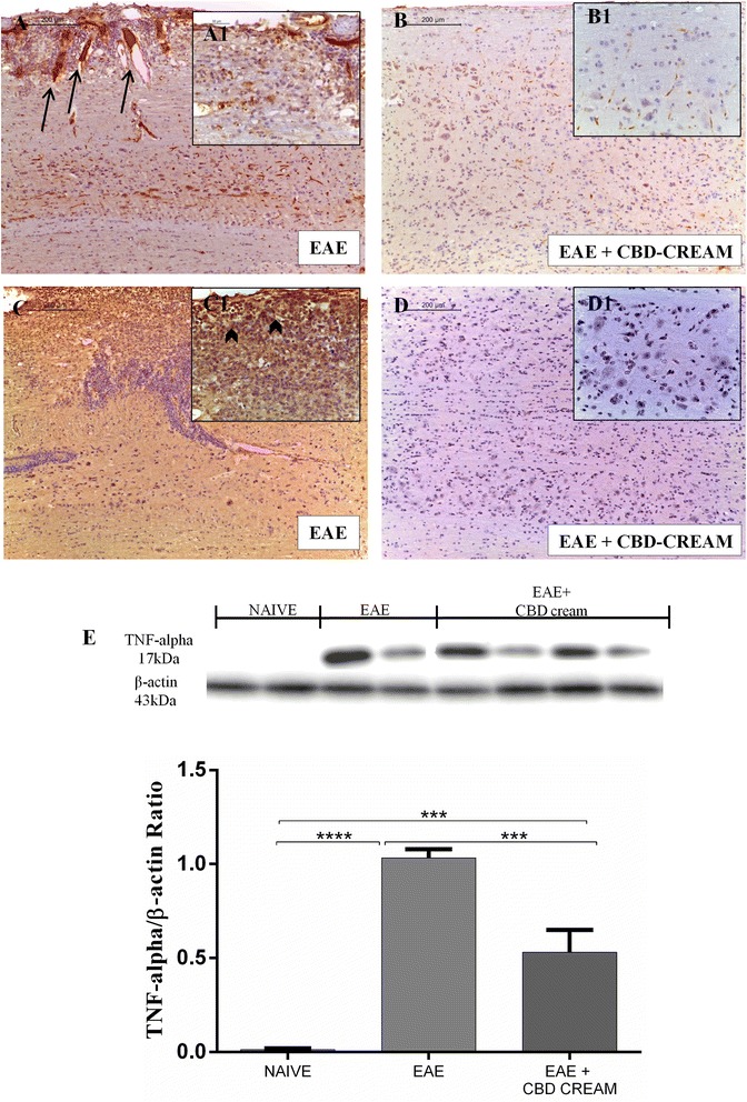 Comparision of p-selectin immunohistochemical localization between EAE mice (a:10x, A1 magnification:40x) and EAE treated mice with 1 % CBD-cream (b:10x, B1 magnification:40x). Immunohistochemical analysis for IL-1β in spinal cord tissues from EAE mice (c:10x, C1 magnification:40x) and mice treated with 1 % CBD-cream (d:10x, D1 magnification:40x). Western blot analysis for TNF-α was showed in e. β-actin was used as internal control. ****p < 0.0001 vs EAE, ***p < 0.0004, ***p < 0.0010 vs EAE + 1 % CBD-cream